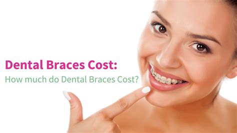 are braces affordable